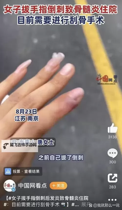 免费在线观看:精彩纷呈的8拔8拔在线观看体验图1