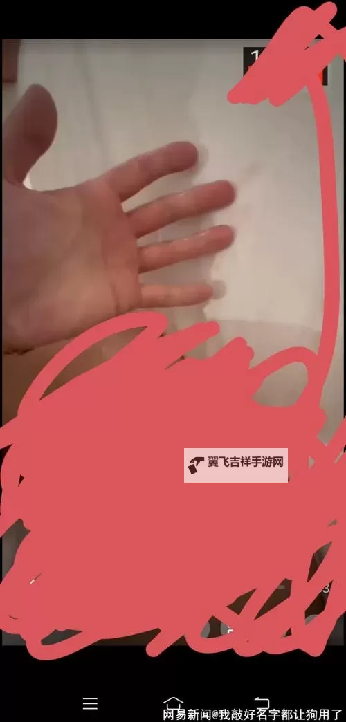 张津瑜口卫生间：保持口腔健康的关键指南图1