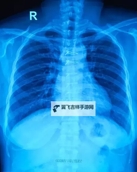 胸片曝光免费观看大全：最新最全的高清资源推荐图1